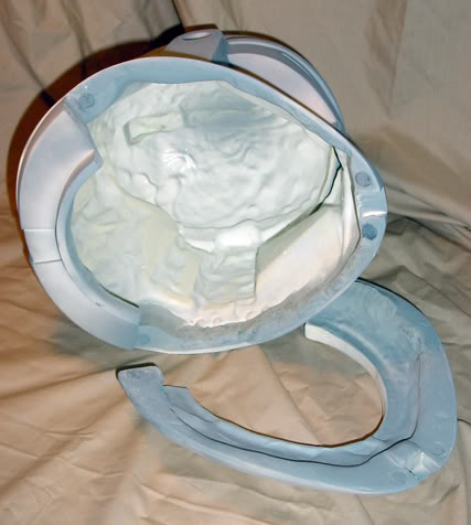 E2neckring.jpg